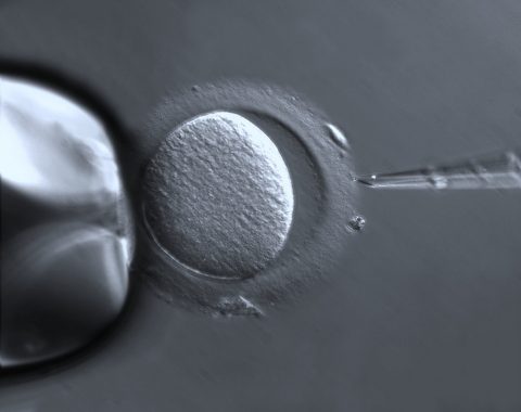 In Vitro
