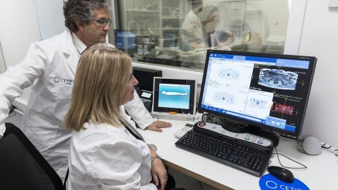 Precisión diagnóstica para evitar la impotencia y la incontinencia, secuelas de la cirugía radical de próstata