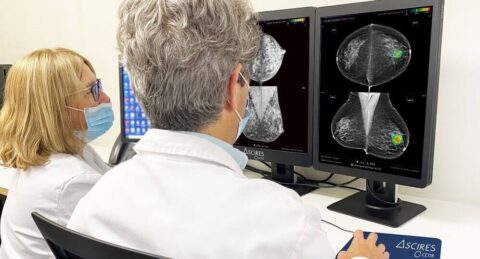 Un software d’IA aconsegueix evitar falsos negatius en càncer de mama amb un 96% de fiabilitat