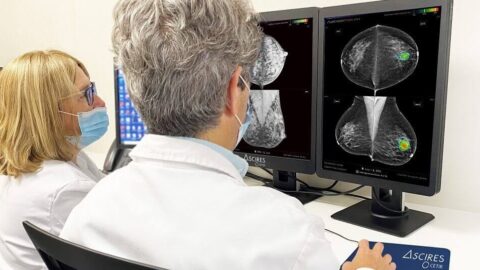 Un software d’IA aconsegueix evitar falsos negatius en càncer de mama amb un 96% de fiabilitat